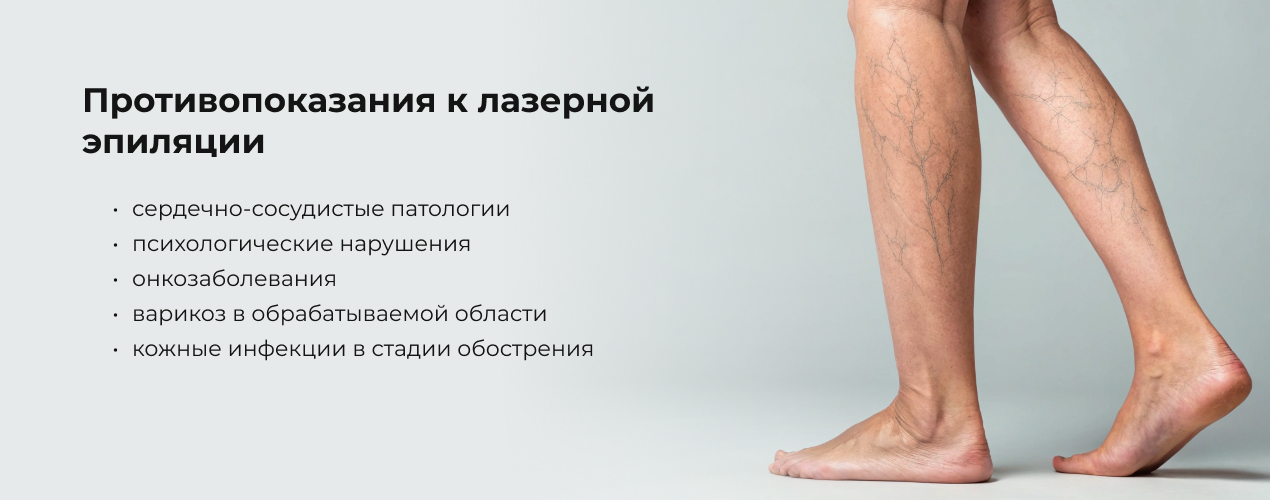 epilation_02.jpg